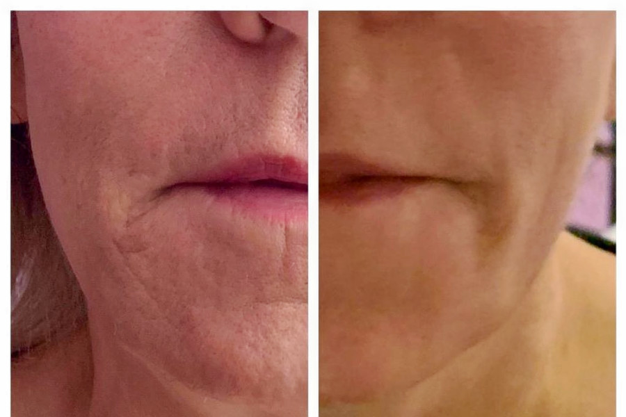 Skin care spot Serenity Aesthetics OC debuts in The Spectrum Hoodline