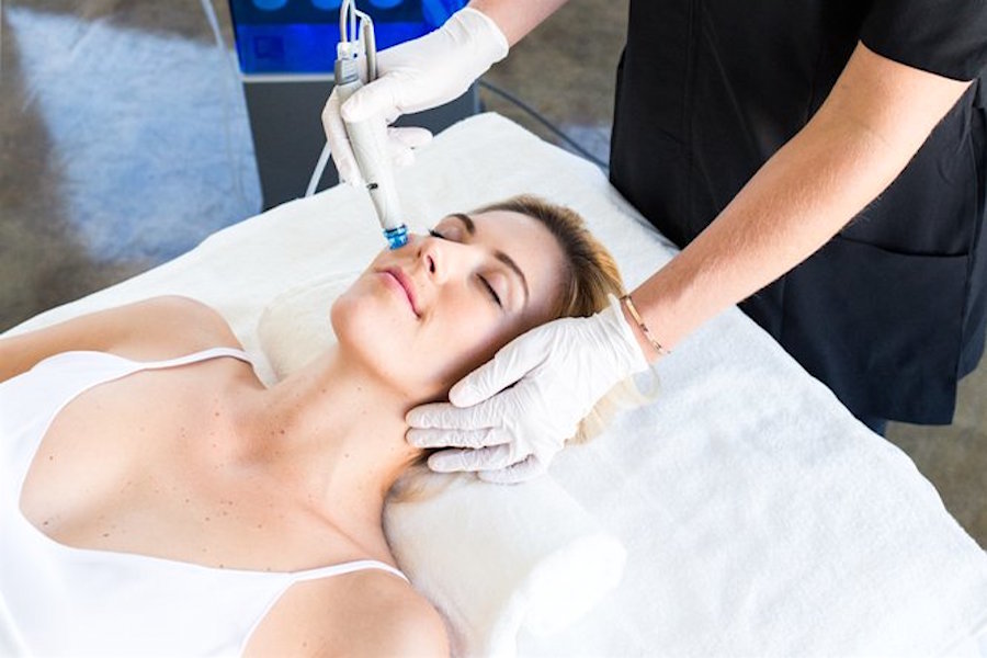 The 3 best laser hair removal spots in Santa Ana
